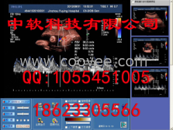 B超工作站软件彩超软件三维超声软件