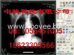 CR工作站CR软件CR胶片打印软件CR