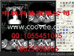 CT工作站CT影像软件CT胶片打印软件